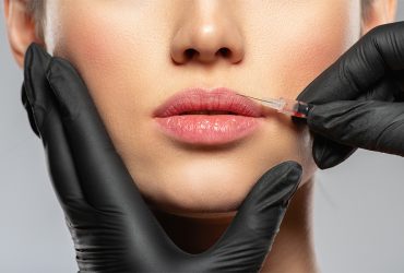 Preenchimento-facial-blog