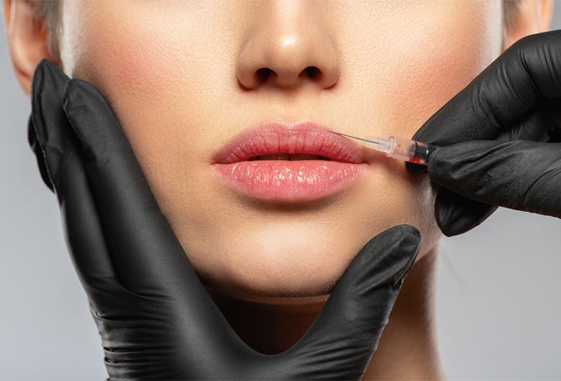 Preenchimento-facial-blog